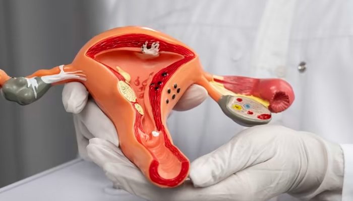 Jumlah Penderita Kanker Leher Rahim dan Payudara Usia 30-50 Tahun